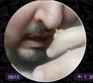 Video sticker 🦯 T