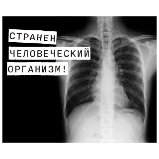 Video sticker 🦴 Доказательство по телу