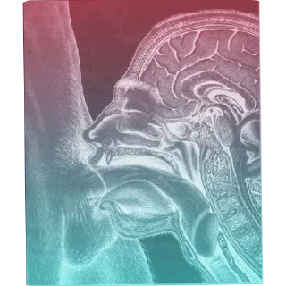 Video sticker 🔳 Fo' cess