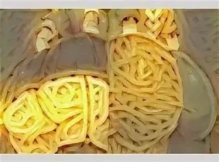 Telegram stiker 🍜 Noods @xvieravelyn @ecchistickers